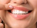 5 easy habits to help keep your gums healthy 